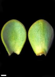Veronica buchananii. Leaf surfaces, adaxial (left) and abaxial (right). Scale = 1 mm.
 Image: W.M. Malcolm © Te Papa CC-BY-NC 3.0 NZ